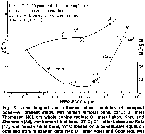 bone diagram